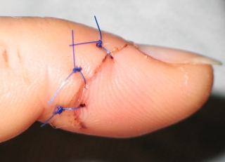 finger 5